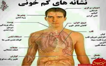 علائم و درمان کم خونی