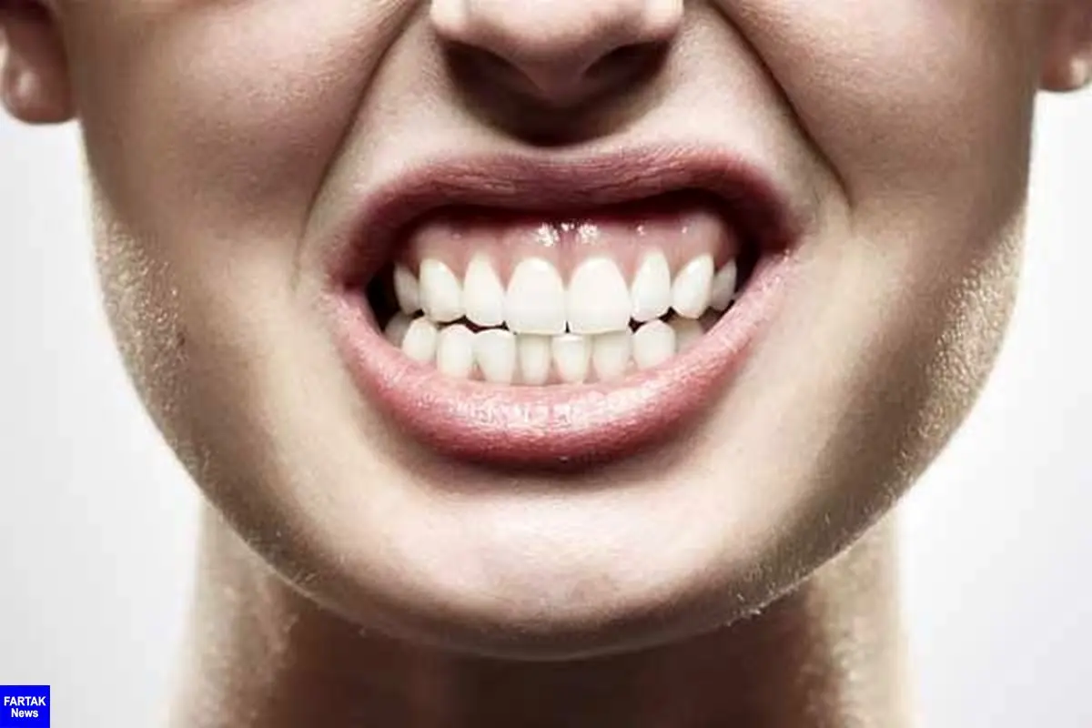 راه حل‌های موثر برای رهایی از مشکل دندان قروچه 