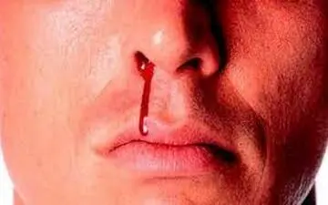 ۲ عامل اصلی ابتلا به سرطان