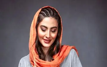 مریم مومن هم بینی‌اش را عمل کرد/خانم بازیگر با این قیافه اصلا قابل شناخت نیست