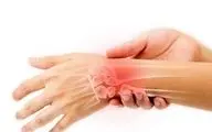 علت درد مچ دست چیست و چطور آن را درمان کنیم؟