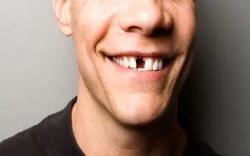 
شیوع بی‌دندانی در ایران پس از ۳۵ سالگی
