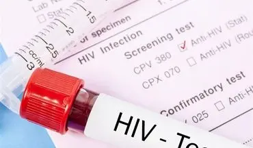 شناسایی حدود ۲۴۰۰۰ مبتلا به HIV در ایران/ مشاوره و درمان ایدز در کدام مراکز رایگان است؟ 