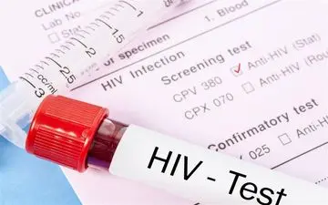 شناسایی حدود ۲۴۰۰۰ مبتلا به HIV در ایران/ مشاوره و درمان ایدز در کدام مراکز رایگان است؟ 