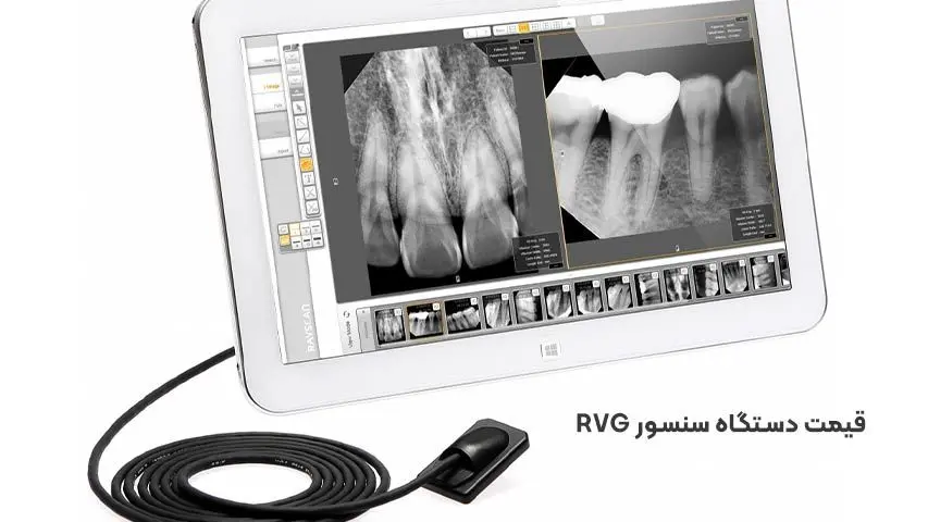قیمت دستگاه سنسور RVG