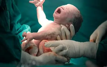 چرا زنان باردار به سزارین بیشتر تمایل دارند؟

