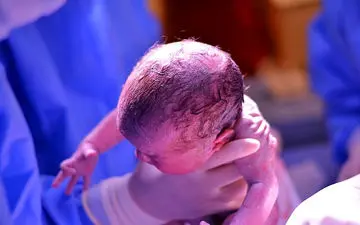 فرمول محاسبه تاریخ دقیق زایمان طبیعی و سزارین