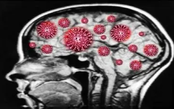 عوارض مغزی پس از ابتلا به ویروس کرونا 