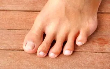 زرد شدن ناخن دست و پا نشانه چیست؟