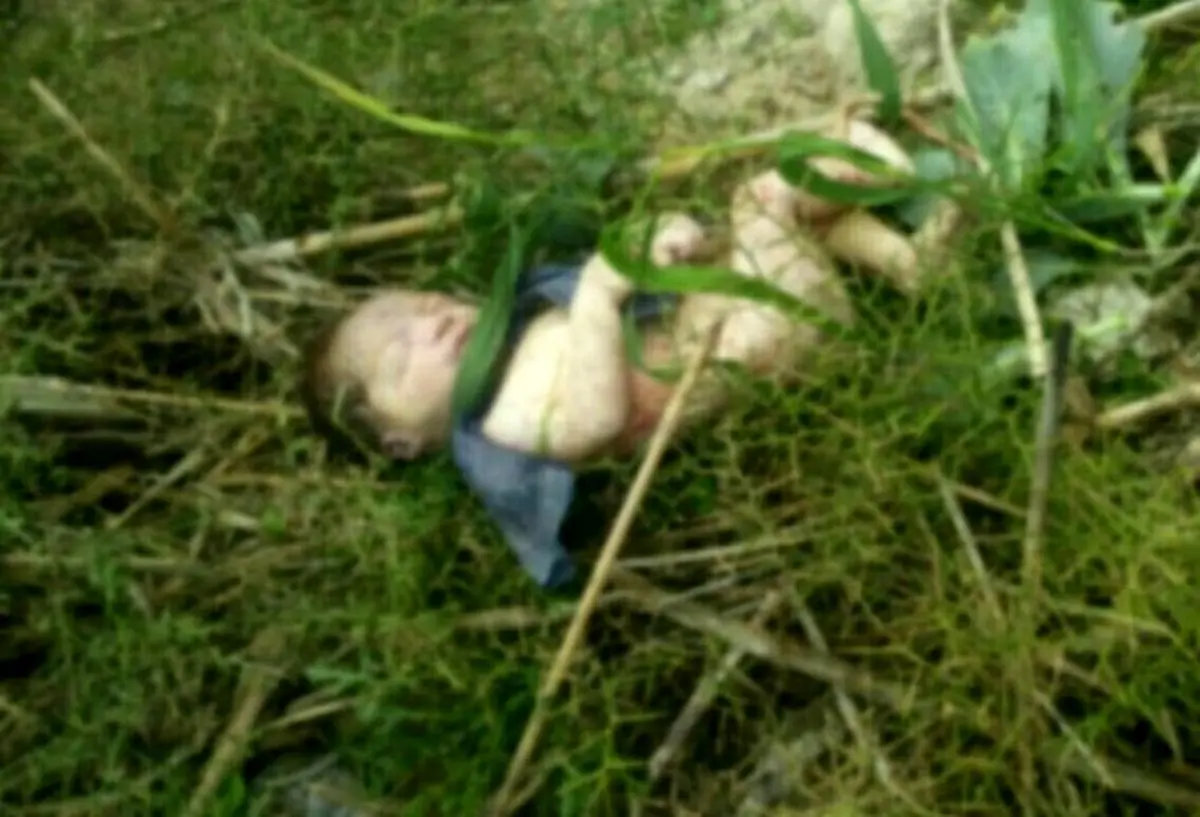 سرنوشت هولناک نوزاد رها شده در جنگل / جای دندان حیوانات روی بدن او بود!+عکس 
