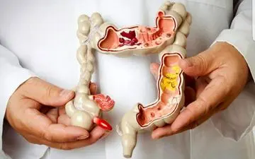 مواد غذایی مضر برای «روده» کدامند؟