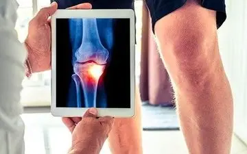 ۸ عامل اصلی که باعث پوکی استخوان می‌شود