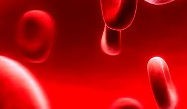 مسموم شدن خون چه علائمی دارد؟