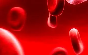 مسموم شدن خون چه علائمی دارد؟