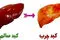 نشانه‌های اولیه کبد چرب که باید بدانید