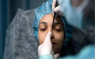 سن عمل زیبایی کاهش یافت/ نوجوانان زیر تیغ جراحی زیبایی