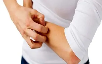 خارش پوست| درمان خانگی خارش پوست