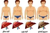 این نوشیدنی ها برای کبد چرب مضره!