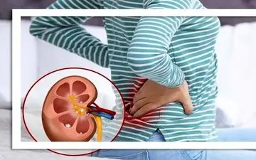 کلید پیشگیری از بیماری مزمن کلیه