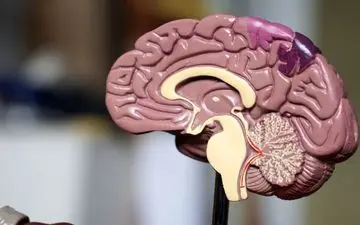 این نشانه ها می گوید سکته مغزی در راه است