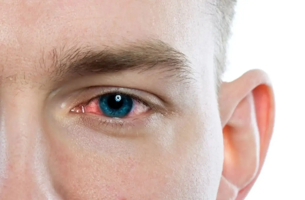 نگهداری از سلامت چشم‌ ها با روش‌های ساده و در دسترس: از شستشو تا کمپرس