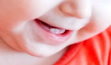 دندان درآوردن موجب کاهش وزن کودک می‌شود؟