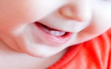 دندان درآوردن موجب کاهش وزن کودک می‌شود؟