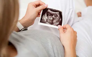 بارداری نادر یک مادر آمریکایی