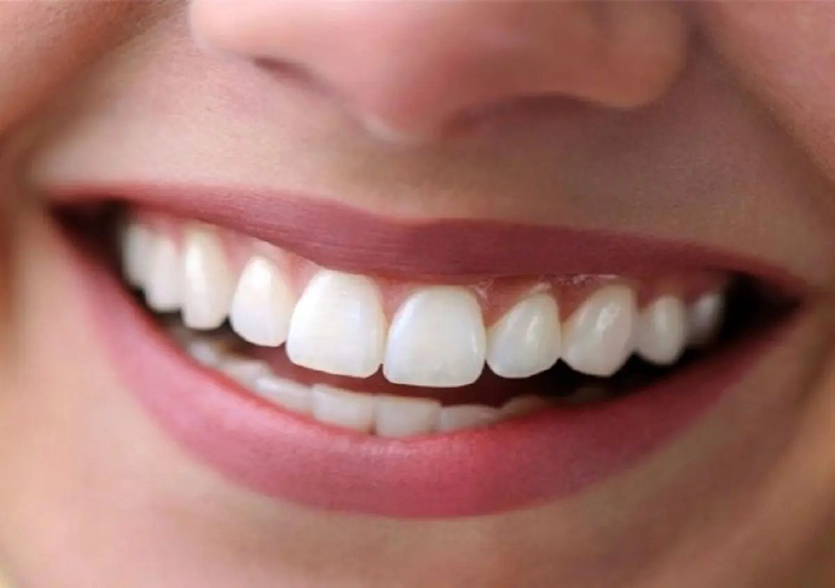 مراقب دندان‌های خود باشید/ راهکارهایی برای بهتر مراقبت از دندان
