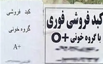 ماجرای فروش کبد ۵۰۰ میلیونی در تهران چه بود ؟