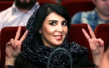 کدام بازیگر جراحی زیبایی نکرده است؟