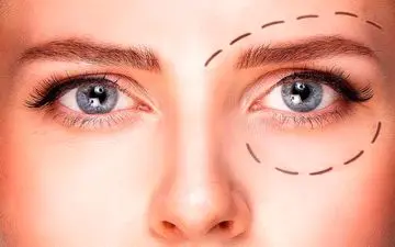 درمان خانگی افتادگی پلک