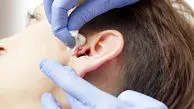 با عفونت پیرسینگ گوش چه کنیم؟