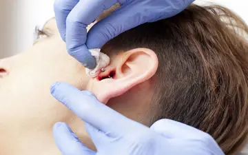 با عفونت پیرسینگ گوش چه کنیم؟