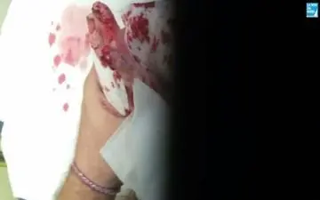 دختر 14 ساله زنده زنده خوراک موش ها شد! + تصاویر