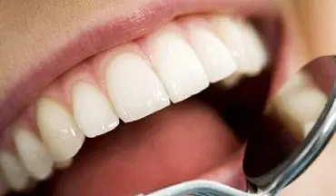 جرم‌گیری دندان ضرر دارد؟