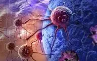  تشخیص زودهنگام سرطان اقدامات درمانی را ممکن می کند