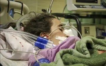 افزایش احتمال بستری کودکان واکسینه نشده کرونایی در بیمارستان