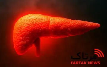 علائم پنهان سرطان پانکراس که نباید نادیده بگیرید