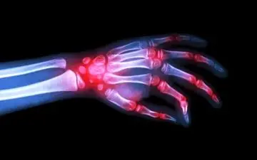  شکستن قولنج چرا با صدا همراه است؟