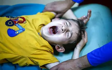 چیزهایی درباره ختنه پسران که نمی دانستید!