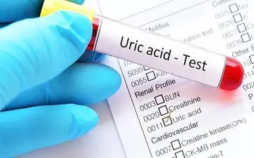 چگونه اسید اوریک بدن را کاهش دهیم؟ راهکارهای ساده و موثر