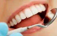 آیا محصولات سفیدکننده به دندان‌ها آسیب می‌زنند؟