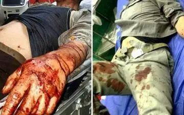 مصدومیت ۵ محیط بان مازندران براثر حمله شکارچیان غیرمجاز