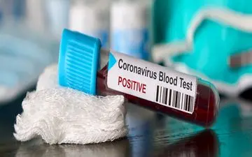 با دیدن علائم ویروس کرونا باید به کجا مراجعه کرد؟