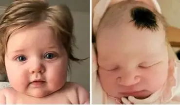  چرا بعضی نوزادان مو دارند و بعضی بدون مو؟
