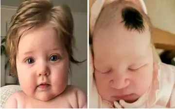  چرا بعضی نوزادان مو دارند و بعضی بدون مو؟