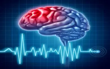 شایع‌ترین علت سکته مغزی بشناسید