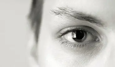 روش های درمان خشکی چشم