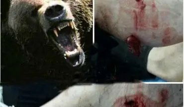 حمله خرس به کودک 10 ساله در چهارمحال و بختیاری + عکس